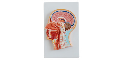 Mediaan van het Hoofd Model, Budget