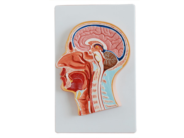 Mediaan van het Hoofd Model, Budget