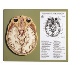 Horizontale Doorsnede Hoofd Model