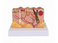 Anatomisch Model Huid met Ziektebeelden