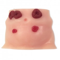 Stoma verzorging oefenmodel