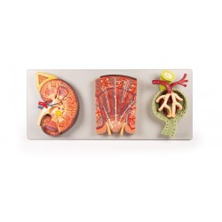 Doorsnede Model Nier, Nefron en Nierlichaampje