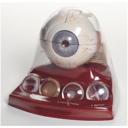 Anatomisch Model Cataract (Staar) Anatomisch Model Cataract (Staar)