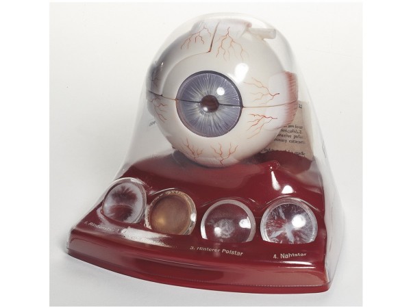 Anatomisch Model Cataract (Staar)