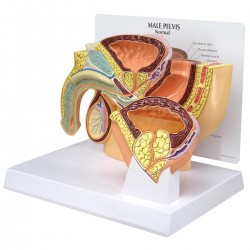 Mannelijk Bekken met BPH