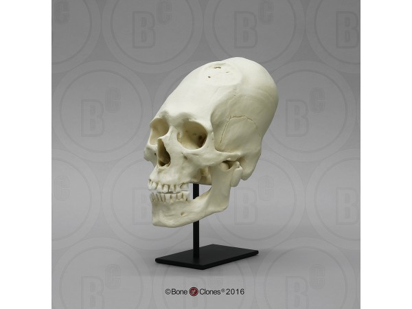 Mannelijk Model Schedelbinding en Trepanatie