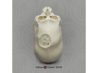 Mannelijk Model Schedelbinding en Trepanatie