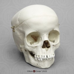 Schedels: Schedel kind 5 jaar