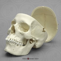 Schedelmodel Europese Vrouw met los schedeldak