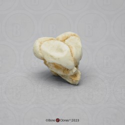 Schedelmodel Foetus 13 weken