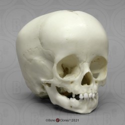 Schedelmodel Kind, 1 jaar