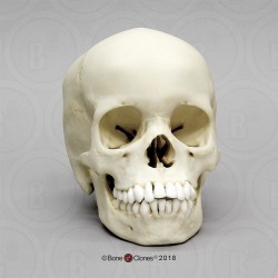 Schedelmodel Kind, 13 jaar