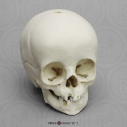 Schedelmodel Kind, 14 maanden