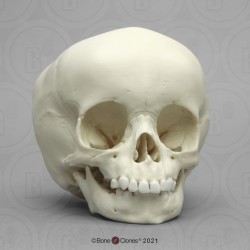 Schedelmodel Kind, 15 maanden