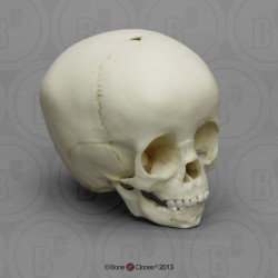 Schedelmodel Kind, 18 maanden