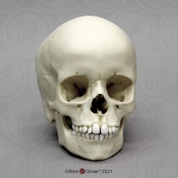 Schedelmodel Kind, 6 jaar