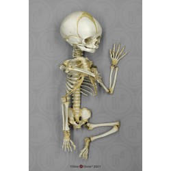 Foetus skelet, beweeglijk gemonteerd Foetus skelet, beweeglijk gemonteerd