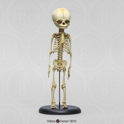 Foetus skelet, vaste montage Foetus skelet, vaste montage