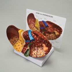 Lever met ziektebeelden