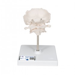 Atlas, draaier & occipitaal bot Atlas, draaier & occipitaal bot