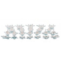 Individuele Wervels (C1 t/m L5) Individuele Wervels (C1 t/m L5)
