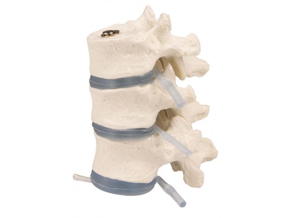 Borstwervels Model