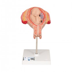 Foetus model stuitligging maand 5 Foetus model stuitligging maand 5