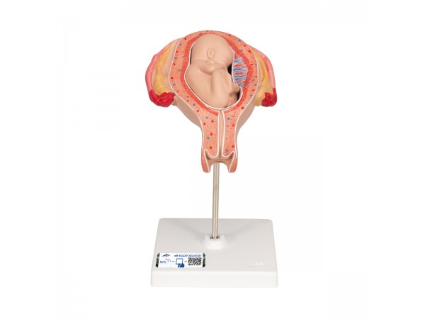 Foetus model stuitligging maand 5