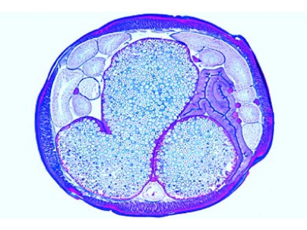 Ascaris megalocephala Embryologie Preparatenset