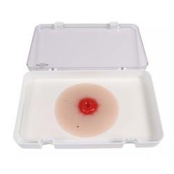 Colostomie Wondmodel, Zelfklevend Colostomie Wondmodel, Zelfklevend