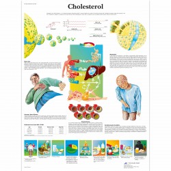 Cholesterol, gelamineerde wandplaat