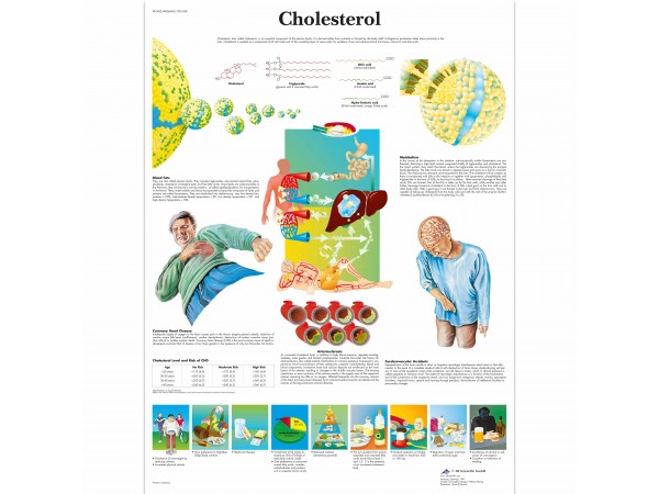 Cholesterol, gelamineerde wandplaat