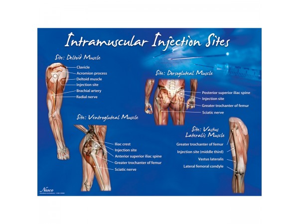 Intramusculaire Injectie Poster