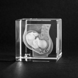 Anatomie Glasblok Baby in Buik