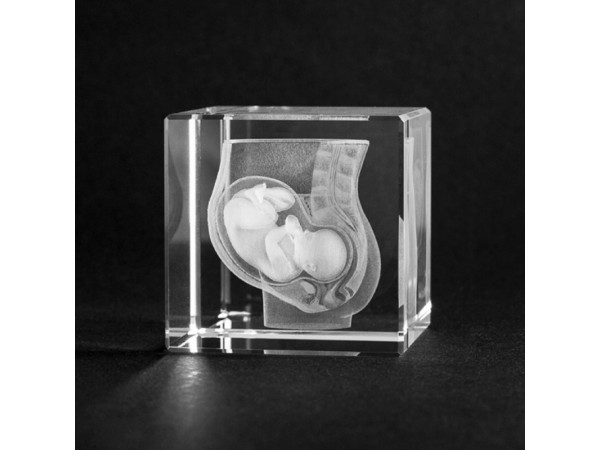 Anatomie Glasblok Baby in Buik