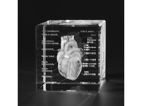 Anatomie Glasblok Hart met benamingen