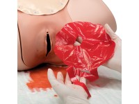 Placenta´s voor Post-partumbloeding trainer