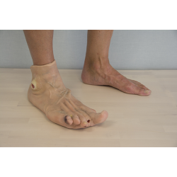 Draagbaar Diabetisch Voetmodel