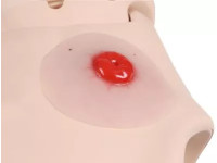 Colostomie Wondmodel, Zelfklevend