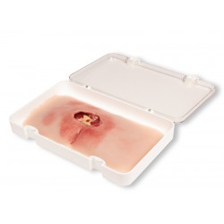 Decubitus Wond Model, Gereinigd