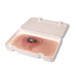 Decubitus Wond Model, Onbehandeld Decubitus Wond Model, Onbehandeld