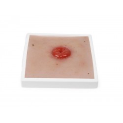Colostoma Model Colostoma Model