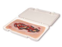 Arteriële Beenzweer Wond, Exsudatiefase