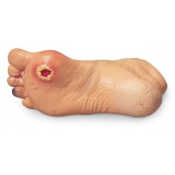 Uitgebreid Voetproblemen Model