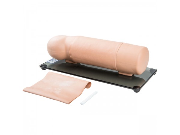 Anticonceptie Implantaat Arm