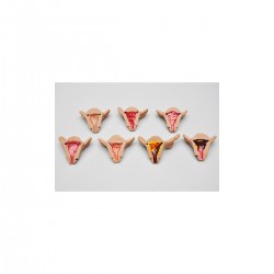 Baarmoeder Set, normaal en interne aandoeningen