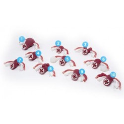 Baarmoeders met extern voelbare aandoeningen voor Uitgebreide Gynaecologische Vaardigheidstrainer