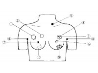 Borstkanker Palpatie Model