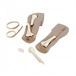 Botbreuk Foto Simulator