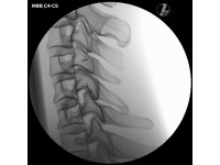 Beeldgeleide Cervicale Wervelkolom Injectie Simulator